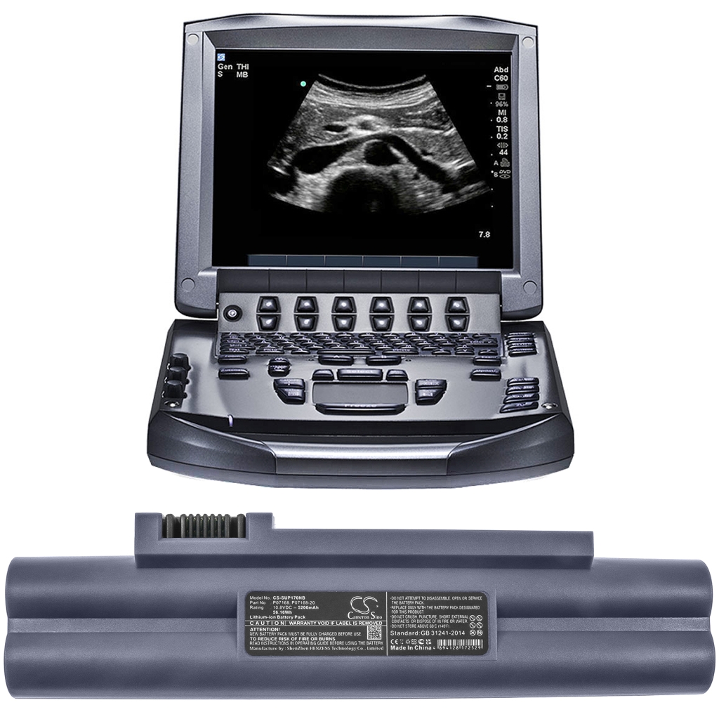 Batería Médica Sonosite CS-SUP170NB